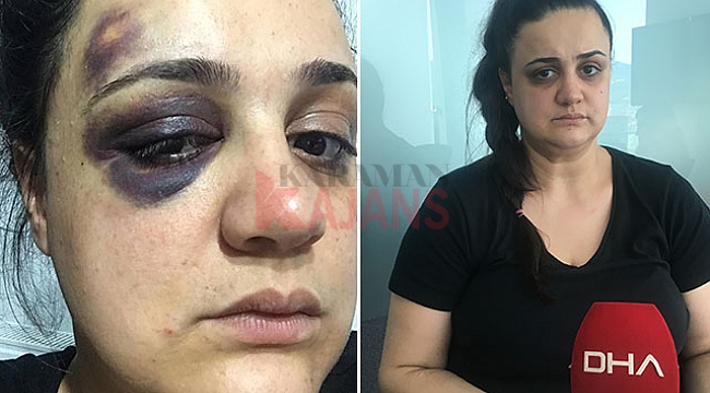 Kadına şiddet davasındaki karar protesto edildi