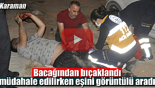 Karaman'da bacağından bıçaklandı, eşini görüntülü arayıp beni vurdular dedi